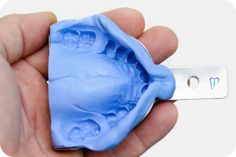 Impresión dental 2