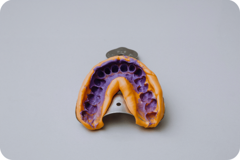 Impresión dental